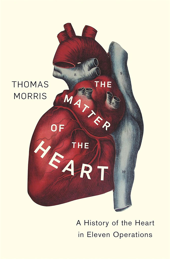The Matter Of The Heart : A History of the Heart in Eleven Operations