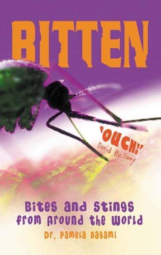 [9781904132615-1] Bitten! : Bites and Stings from Around the World