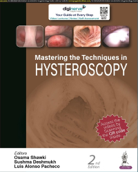 [9789354657559-1] Mastering the Techniques in Hysteroscopy